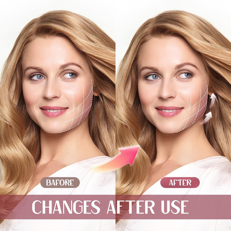 Double Chin Reducer Strap for Women, Reusable V Line Lifting