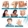 NewGel+ Advanced Silicone Professional Scar Treatment Tape for Abdomen and