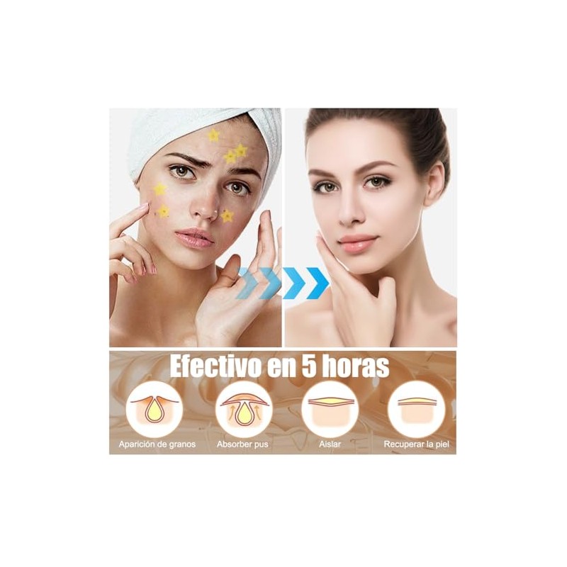 32 Piezas Parches para Acné Estrellas,Estrellas Pimple Patch,Parches Estrellas Acne,Parches