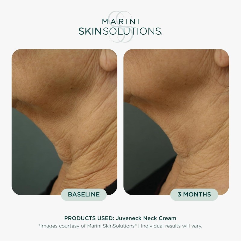 Juveneck Neck Cream by Marini SkinSolutions for Unisex - 1.7