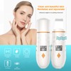 Ultrasonic Shovel Facial Skin Scrubber with Heating Pore Cleanser Face