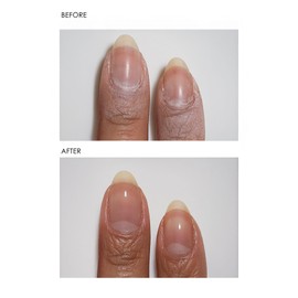 Dermelect Clean & Care Nail Renewal Kit – Nail Treatment Set with Ridge Filler, Nail Brightener & Polish Remover Wipes – Strengthens, Brightens & Restores Damaged, Discolored, Weak Nails