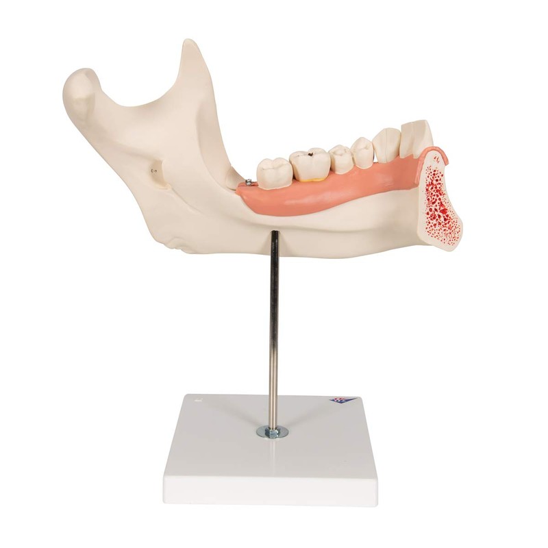 3B Scientific D25 6 Part Half Lower Jaw Model, 3
