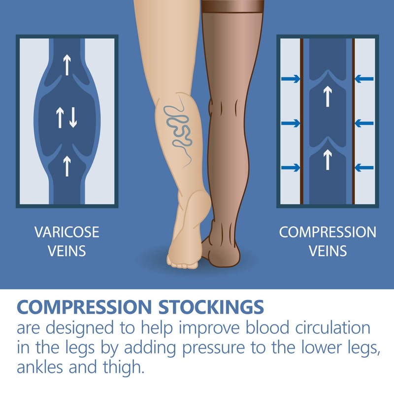 Medical Compression Tights with Compression / Unisex 16-18 mmHg XS