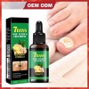 Lápiz Líquido Reparador De Uñas, Tratamiento Para Hongos En