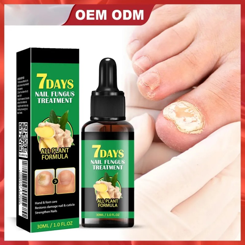 Lápiz Líquido Reparador De Uñas, Tratamiento Para Hongos En