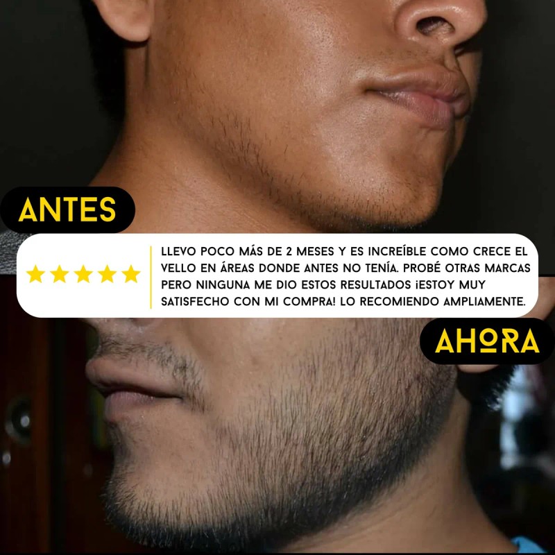 Balsamo Realgrow Para Crecer Y Engrosar La Barba Cítrica