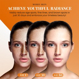 Organic Turmeric Soap Bar for Face, Kojic Acid Soap for Hyperpigmentation, Premium Japanese Formulated Kojic Soap Enriched with Vitamin C, Retinol, Collagen | 2-Bars + Mesh Net, 3.53 oz Each