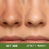 Mascarilla De Arcilla Para Cara, Holy Basil Bubble Deep Clea