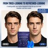OROS Eye Patches for Men, Hyaluronic Acid & Peptide Complex