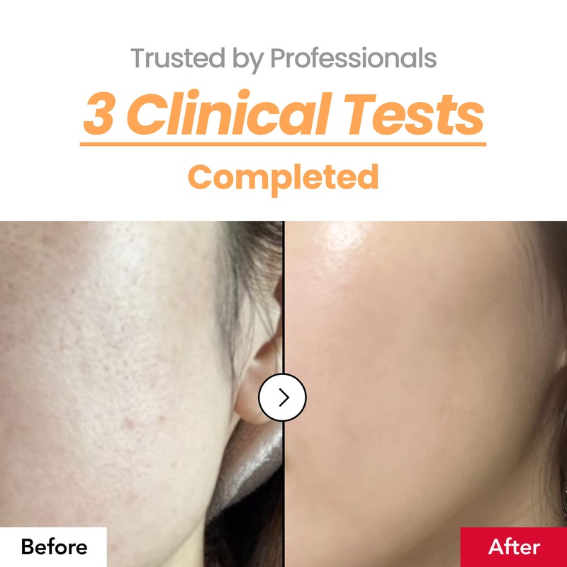 Dr.Percent [Dr.Percent]*TIMEDEAL* Skin Texture Booster 214% Essence 150ml