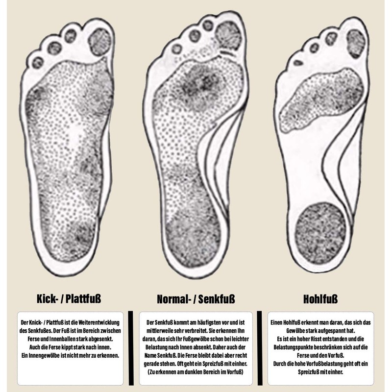 Green-feet Thin, 3mm Thin Orthopaedic Schuh-einlage-n for Fallen Arches, Flatfoot,