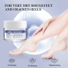 Crema De Urea Crema Intensiva De Ácido Salicílico Urea P