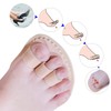 Price Xes Toe Splint & Straightener, Adjustable Loops Hammer Toe