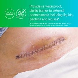 Tegaderm 3M? Tegaderm? Transparent Film Dressing Frame Style, 1628, 6 in x 8 in (15 cm x 20 cm), 10/ct 8ct/Case