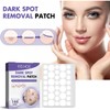 144pcs Dark Spot Removal Patch Blemish Patches with Vitamin C