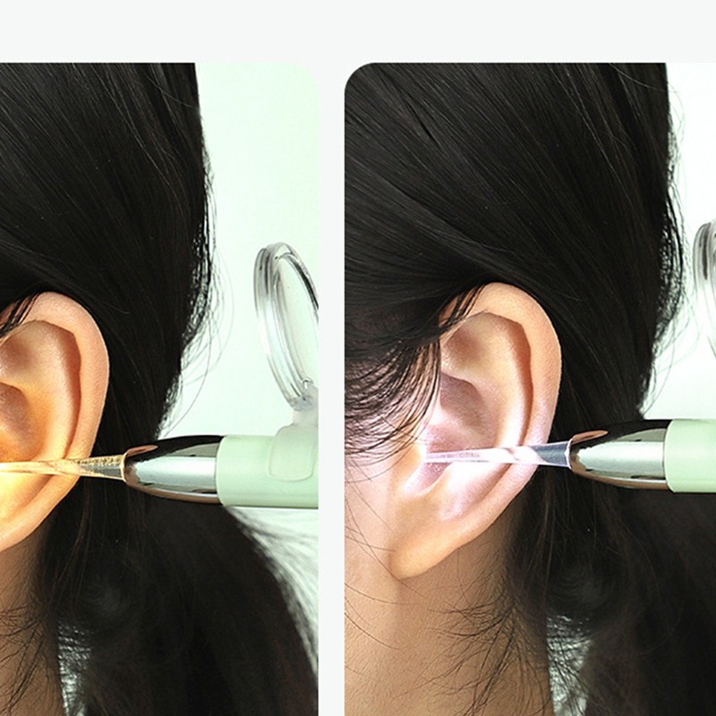 LED Lighted Earpick Set Ear Wax Removal Noseclip Forceps Bright