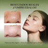 Kit Oxyglow 3 Pasos Elimina Puntos Negrostecnología Bambú + Nopalextracción