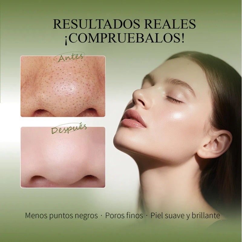 Kit Oxyglow 3 Pasos Elimina Puntos Negrostecnología Bambú + Nopalextracción