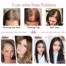 gulagula 14 Inch Hair Toppers for Women Toppers Hair Pieces for Women Wiglets Hairpieces for Thinning Hair Topper Synthetic Hair Piece Wig Toppers for Women with Thinning Hair