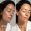 Kit Rutina Facial Despigmentante Meladermic Crema Día Noche