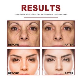 Retinol Serum, Retinol B3 Serum, Anti-Falten Serum, Retinol Serum Gesicht, Retinol und B3 Gesichtsserum, Anti-Aging Serum für Feine Linien und Falten, Hautreparatur, 30 ml