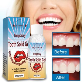HERBENJOY Temporary Tooth Filling, Moldable Temporary Tooth Repair for False Teeth, Dental Repair Beads for Chipped & Broken Tooth, Quick Fix Tooth Solid Gel for False Teeth