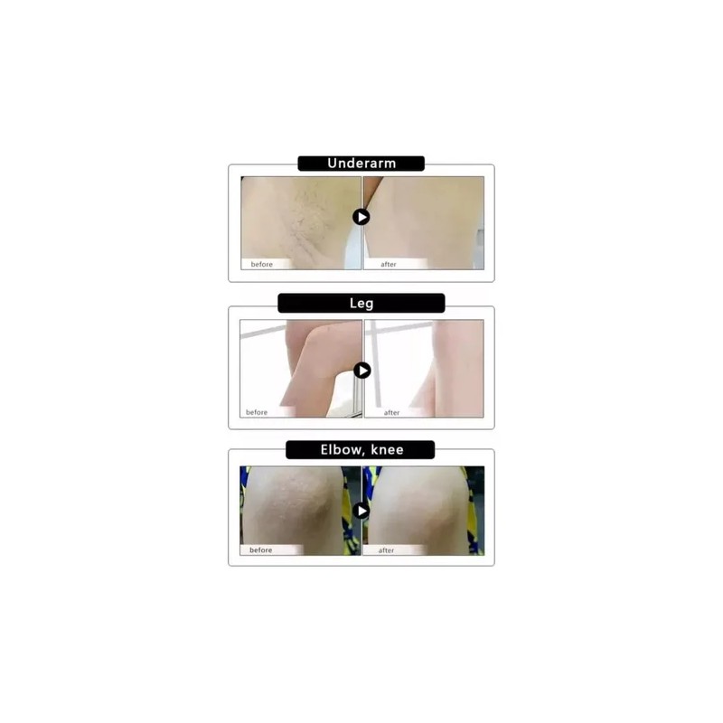 Gel Exfoliante De Arroz Elimina Celulas Muertas, Aclarante