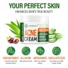 Crema Facial Para El Acné - Tratamiento Localizado Para El
