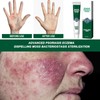 2pcs Hydrating Moisturizing Cream Eczema Erythema Repair Cream Itchy Skin