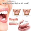 Oralhoe Kit de Rebase de Silicona para Prótesis Dentales, Suave