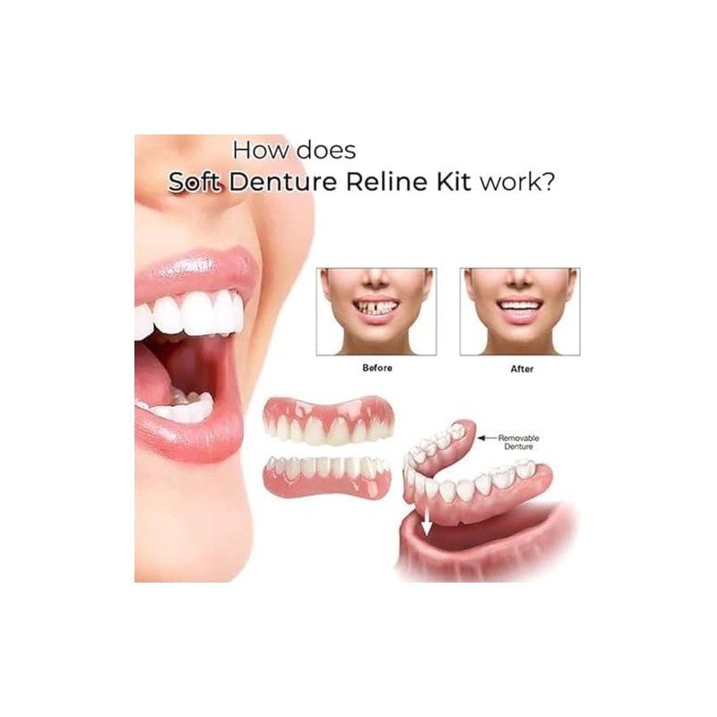 Oralhoe Kit de Rebase de Silicona para Prótesis Dentales, Suave