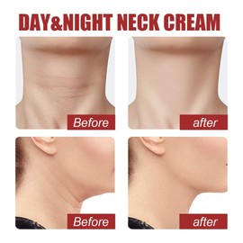 Neck Firming Cream,Tighten and Lift Neck Cream,Anti-Aging Neck Cream,Nec/k Moisturizer Cream,Skin Firming Cream for N/eck Tightening,Ne/ck Firming and Repair Cream,Smoothes Fine Lines & Wrinkles
