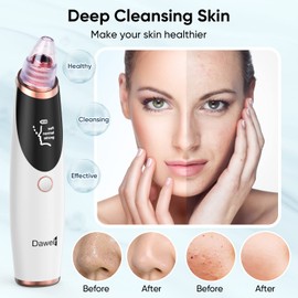 Daweir - Aspiradora de poros para quitar puntos negros, herramientas de extracción de espinillas, herramienta de limpieza de poros para cara y nariz