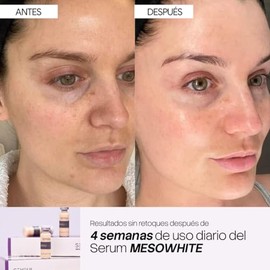 SEYOUL Células Madre Mesowhite Suero Facial Iluminador (Meso Tópico), Niacinamida + DAB Microencapsulado + Ácido Hialurónico 50 kDa, Ayuda a Mejorar la Apariencia de Manchas y Opacidad, Textura Ligera, 6 Frascos