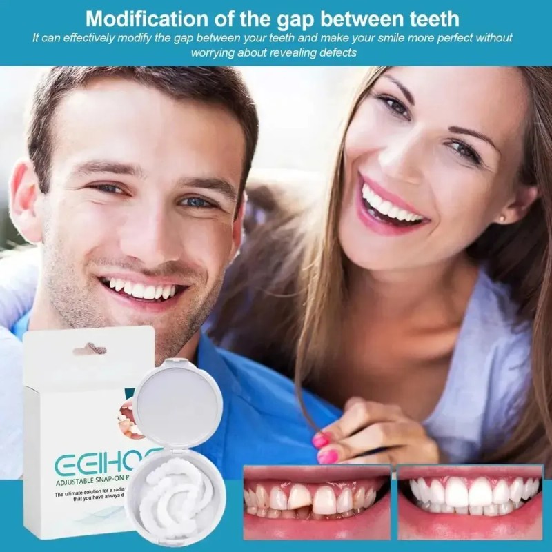 Dientes Postizos Temporal Sonrisa Dental Carilla