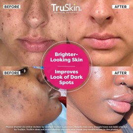 Truskin Vitamin C-plus Super Serum - Suero Facial Antiarruga