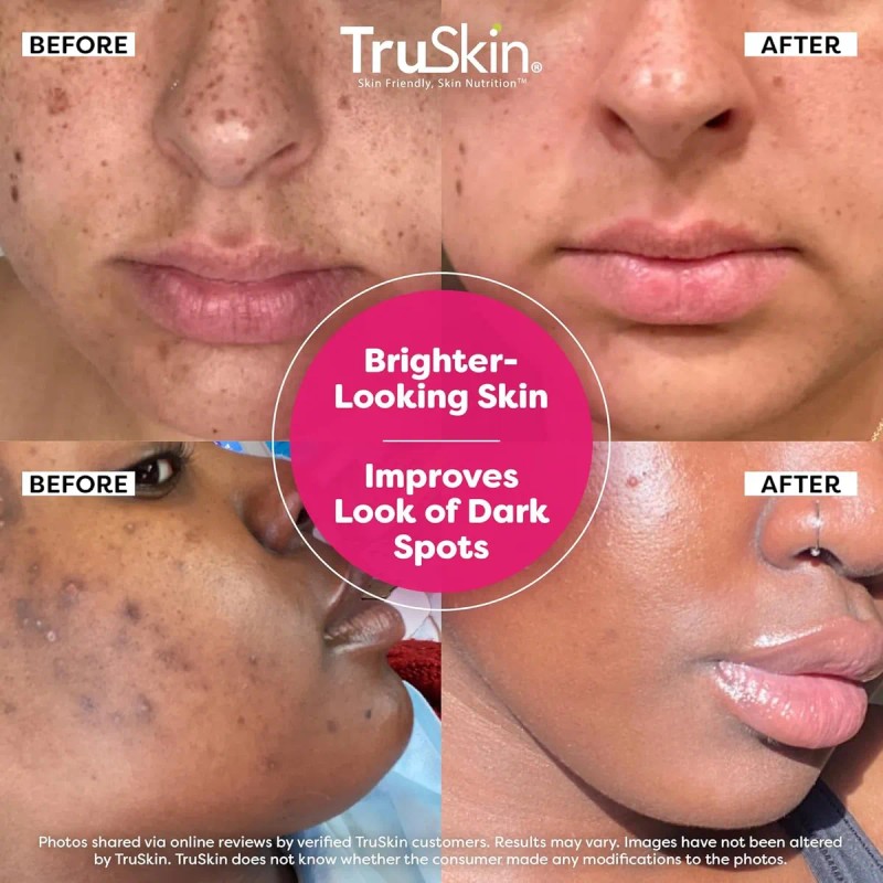 Truskin Vitamin C-plus Super Serum - Suero Facial Antiarruga