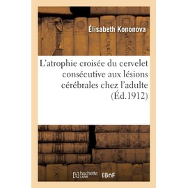L'atrophie croisée du cervelet consécutive aux lésions cérébrales chez l'adulte: Etude anatomo pathologique