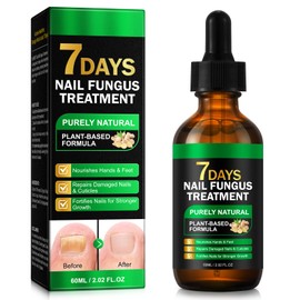 Ginger Nail Treatment, Nail Repair Regrowth Serum Oil for Thick, Discolored, Damaged Brittle Nails/Toenails, Strengthening Toe Beds & Cuticles, Plant-Based, 60ML/2.02 Fl Oz