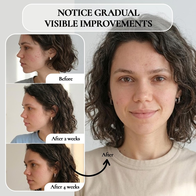 Vivo Per Lei Facial Peeling Gel - Helps Address Dead