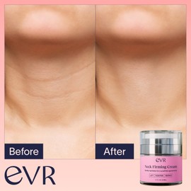 EVR BEAUTY EVR BEAUTY Anti-aging Neck Firming Cream with Collagen & Hyaluronic Acid - Made in USA with Natural & Organic Ingredients Face Neck and Chest Tightening Moisturizer (Classic)