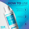 Clg Skincare - Crema Para Venas Varicosas, Loción De Rescate
