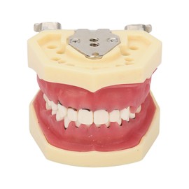 Periodontal Disease Teeth Resin Model Dental Demonstration Teeth Model for Teaching Studying