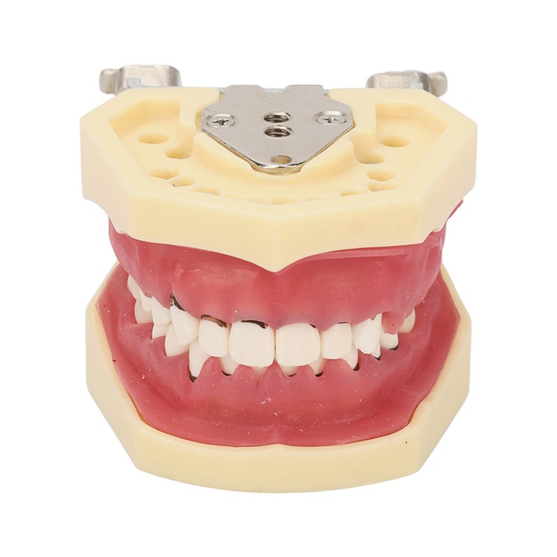 Periodontal Disease Teeth Resin Model Dental Demonstration Teeth Model for