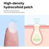 caraseoul Parches Hidrocoloides para el Acné (10/12 mm, 102 Unidades)