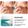 Crema Removedora Mezquinos Verrugas Lunares Eficaz Sin Dolor