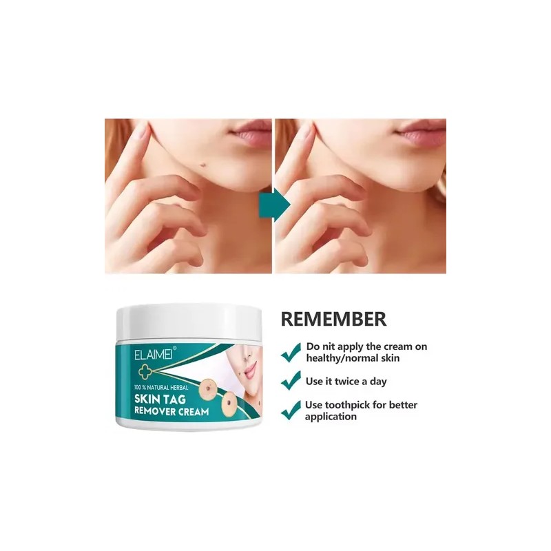 Crema Removedora Mezquinos Verrugas Lunares Eficaz Sin Dolor