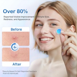 Pimple Patches for Face - Colorful Hydrocolloid Acne Patches with Salicylic Acid, Tea Tree Oil & Centella – 3 Sizes, 5 Cute Shapes Face Zit Stickers for Blemishes Care and Skin Soothing, 60 Counts