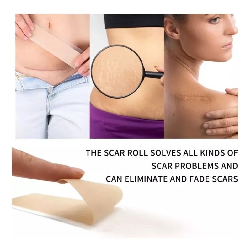 Parche P/cicatriz Abdominoplastia (3m / Original) Neutra